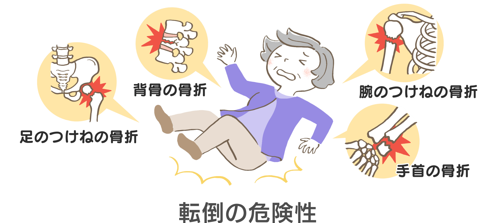 転倒の危険性